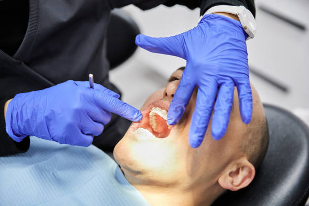 Best Emergency Dental Care for Broken or Chipped Teeth in Hebron, OH